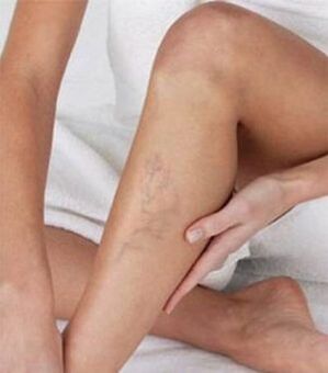 An effective method of treatment