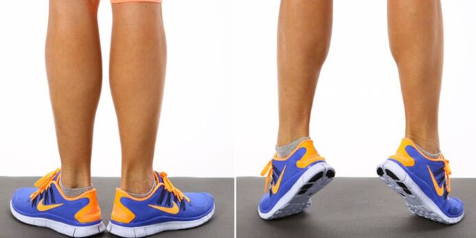 Gymnastics from varicose veins